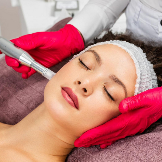 Der große Microneedling-Leitfaden